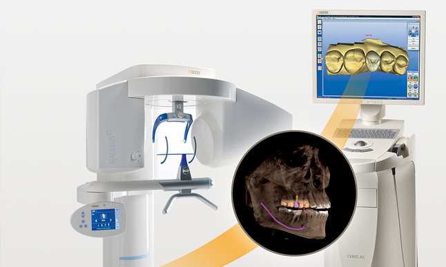 Galileous-CEREC-Implant