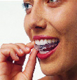 Invisalign